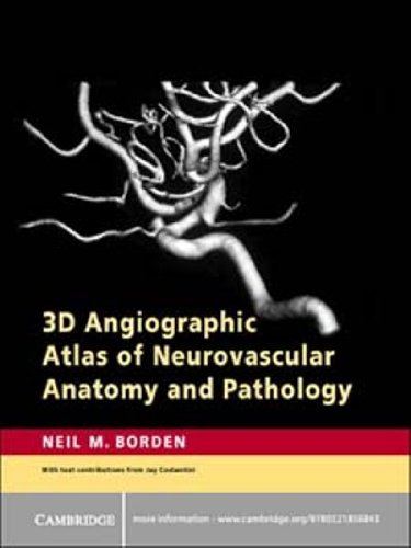 3D Angiographic Atlas of Neurovascular Anatomy and Pathology (PDF/EPUB Version)
