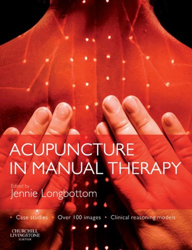Acupuncture in Manual Therapy (PDF/EPUB Version)