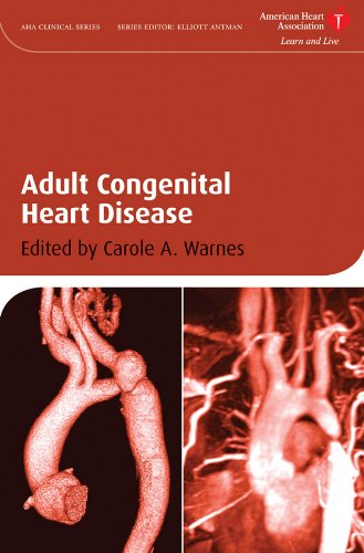 Adult Congenital Heart Disease (American Heart Association Clinical Series Book 16) (PDF/EPUB Version)