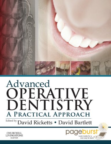 Advanced Operative Dentistry: A Practical Approach (PDF/EPUB Version)