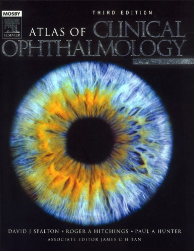 Atlas of Clinical Ophthalmology (PDF/EPUB Version)