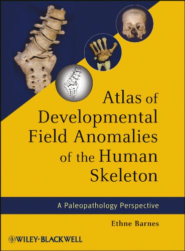 Atlas of Developmental Field Anomalies of the Human Skeleton: A Paleopathology Perspective (PDF/EPUB Version)