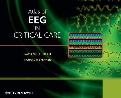 Atlas of EEG in Critical Care (PDF/EPUB Version)
