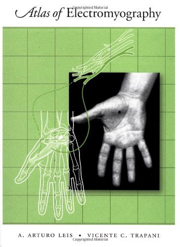 Atlas of Electromyography (PDF/EPUB Version)
