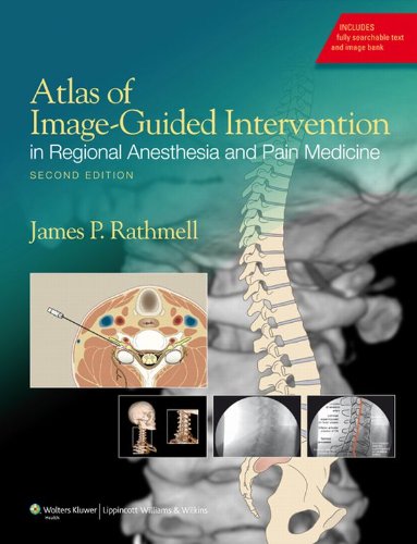 Atlas of Image-Guided Intervention in Regional Anesthesia and Pain Medicine (PDF/EPUB Version)