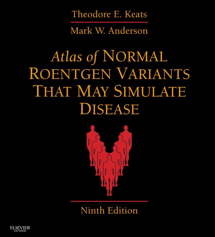 Atlas of Normal Roentgen Variants That May Simulate Disease E-Book: Expert Consult - Enhanced Online Features and Print (PDF/EPUB Version)