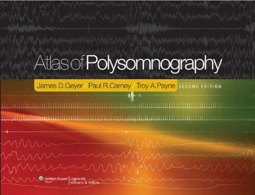 Atlas of Polysomnography (PDF/EPUB Version)