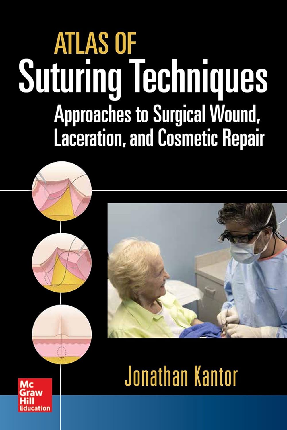 Atlas of Suturing Techniques: Approaches to Surgical Wound, Laceration, and Cosmetic Repair (PDF/EPUB Version)