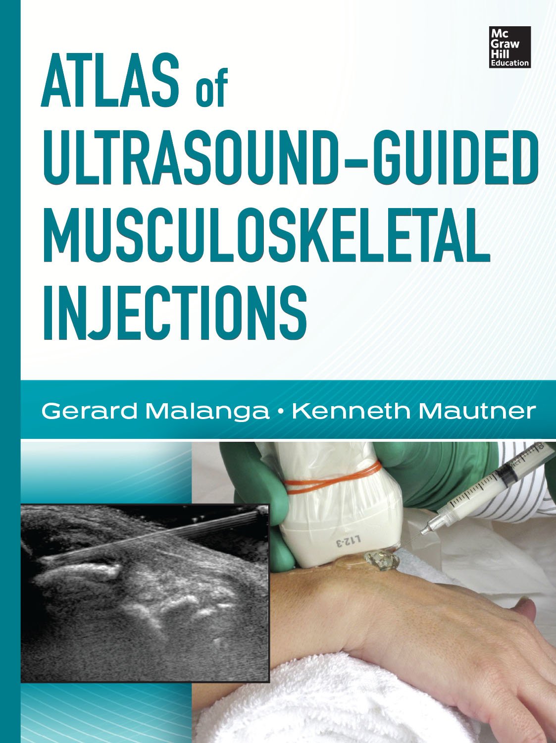 Atlas of Ultrasound-Guided Musculoskeletal Injections (Atlas Series) (PDF/EPUB Version)