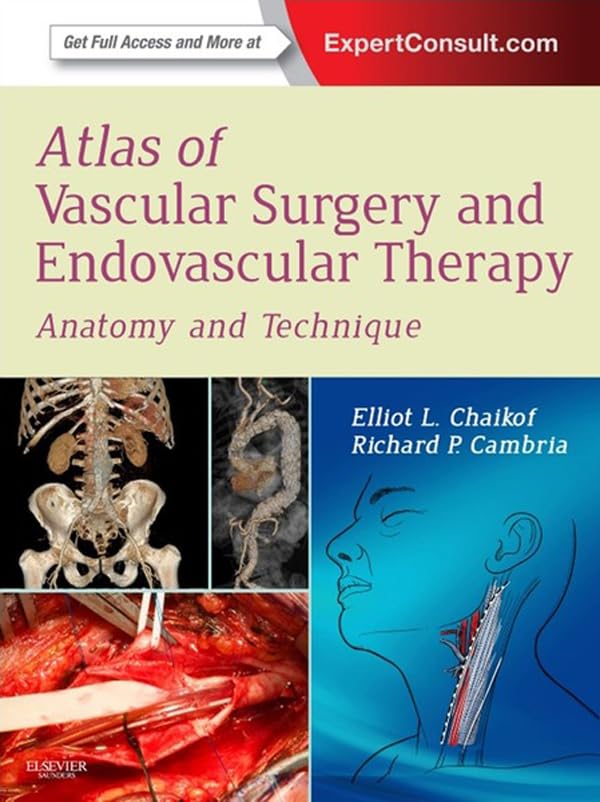 Atlas of Vascular Surgery and Endovascular Therapy E-Book (PDF/EPUB Version)