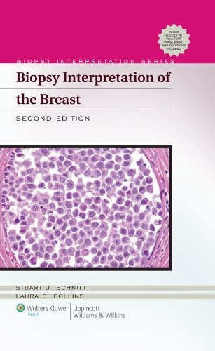 Biopsy Interpretation of the Breast (Biopsy Interpretation Series) (PDF/EPUB Version)