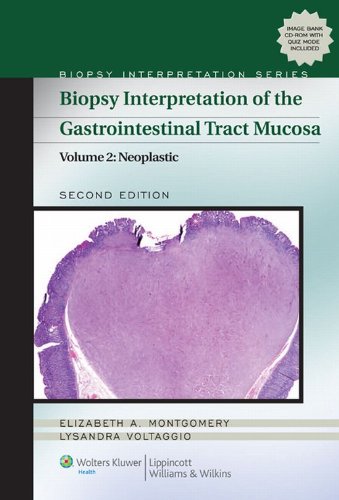 Biopsy Interpretation of the Gastrointestinal Tract Mucosa: Volume 2: Neoplastic (Biopsy Interpretation Series) (PDF/EPUB Version)