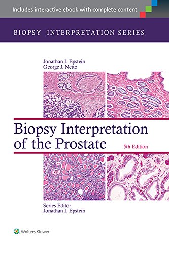 Biopsy Interpretation of the Prostate (Biopsy Interpretation Series) (PDF/EPUB Version)