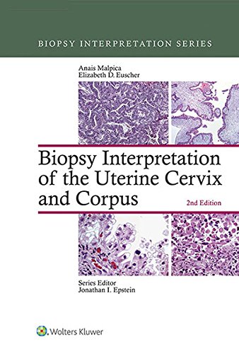 Biopsy Interpretation of the Uterine Cervix and Corpus (Biopsy Interpretation Series) (PDF/EPUB Version)