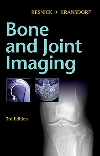 Bone and Joint Imaging (PDF/EPUB Version)