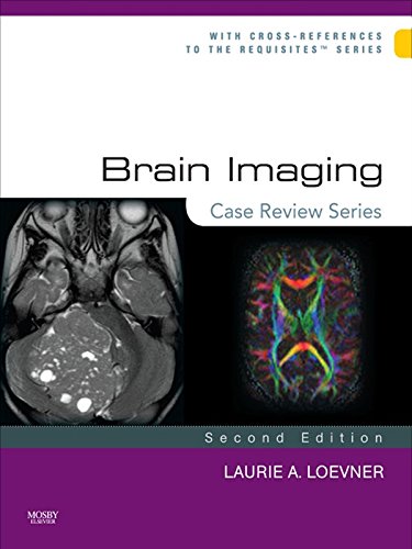 Brain Imaging: Case Review Series (PDF/EPUB Version)
