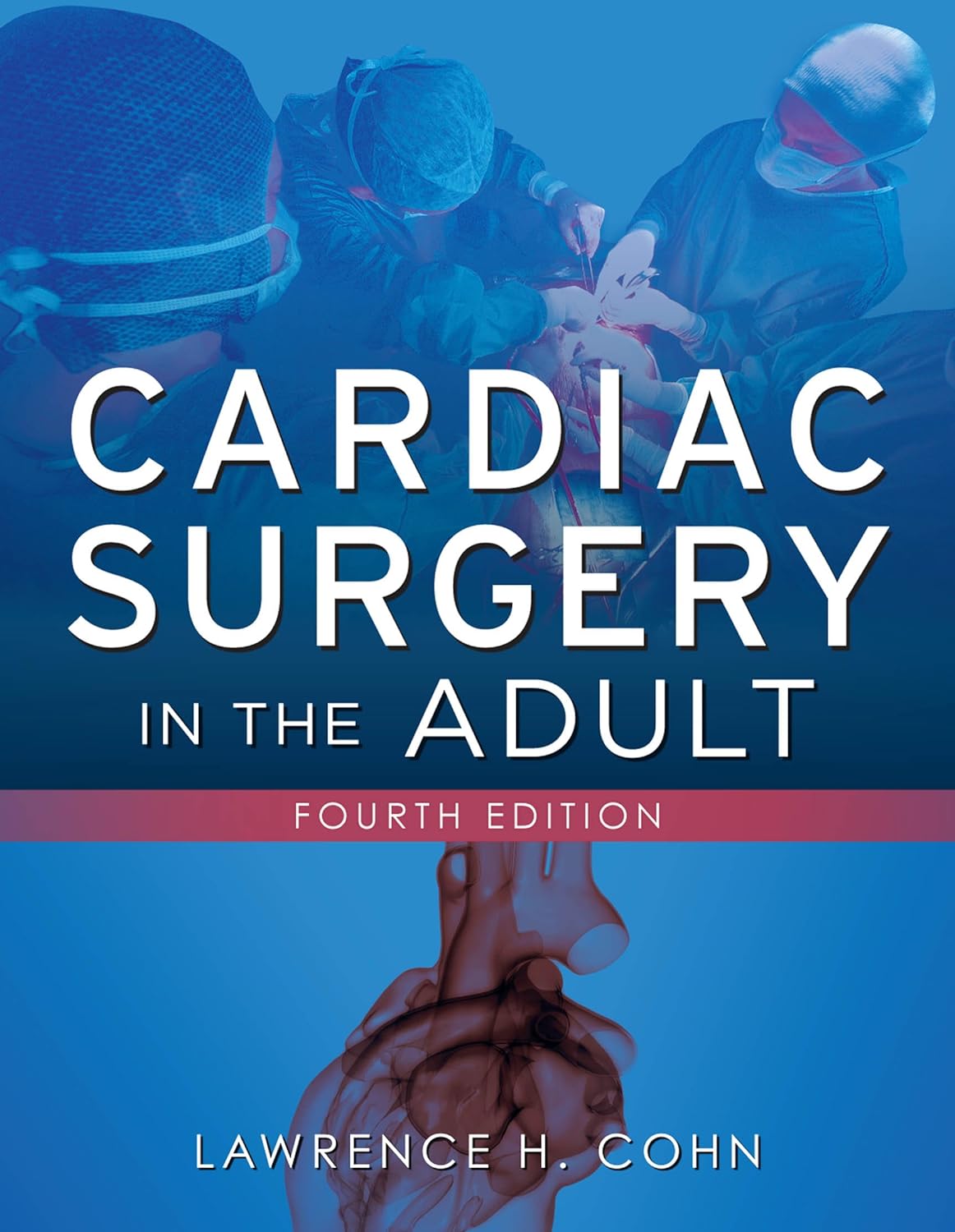 Cardiac Surgery in the Adult, Fourth Edition (PDF/EPUB Version)