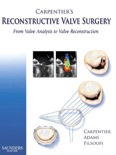 Carpentier's Reconstructive Valve Surgery (PDF/EPUB Version)