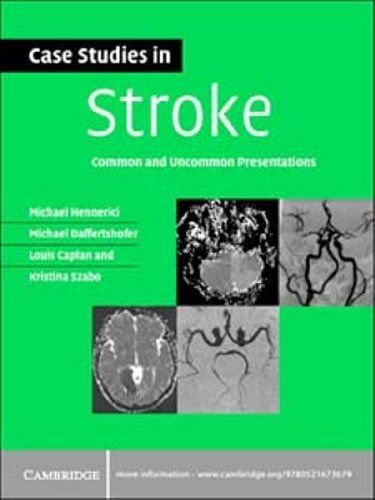Case Studies in Stroke: Common and Uncommon Presentations (Case Studies in Neurology) (PDF/EPUB Version)