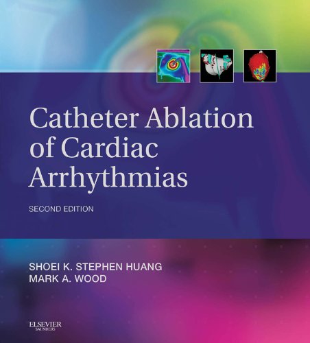 Catheter Ablation of Cardiac Arrhythmias: Expert Consult – Online and Print (PDF/EPUB Version)