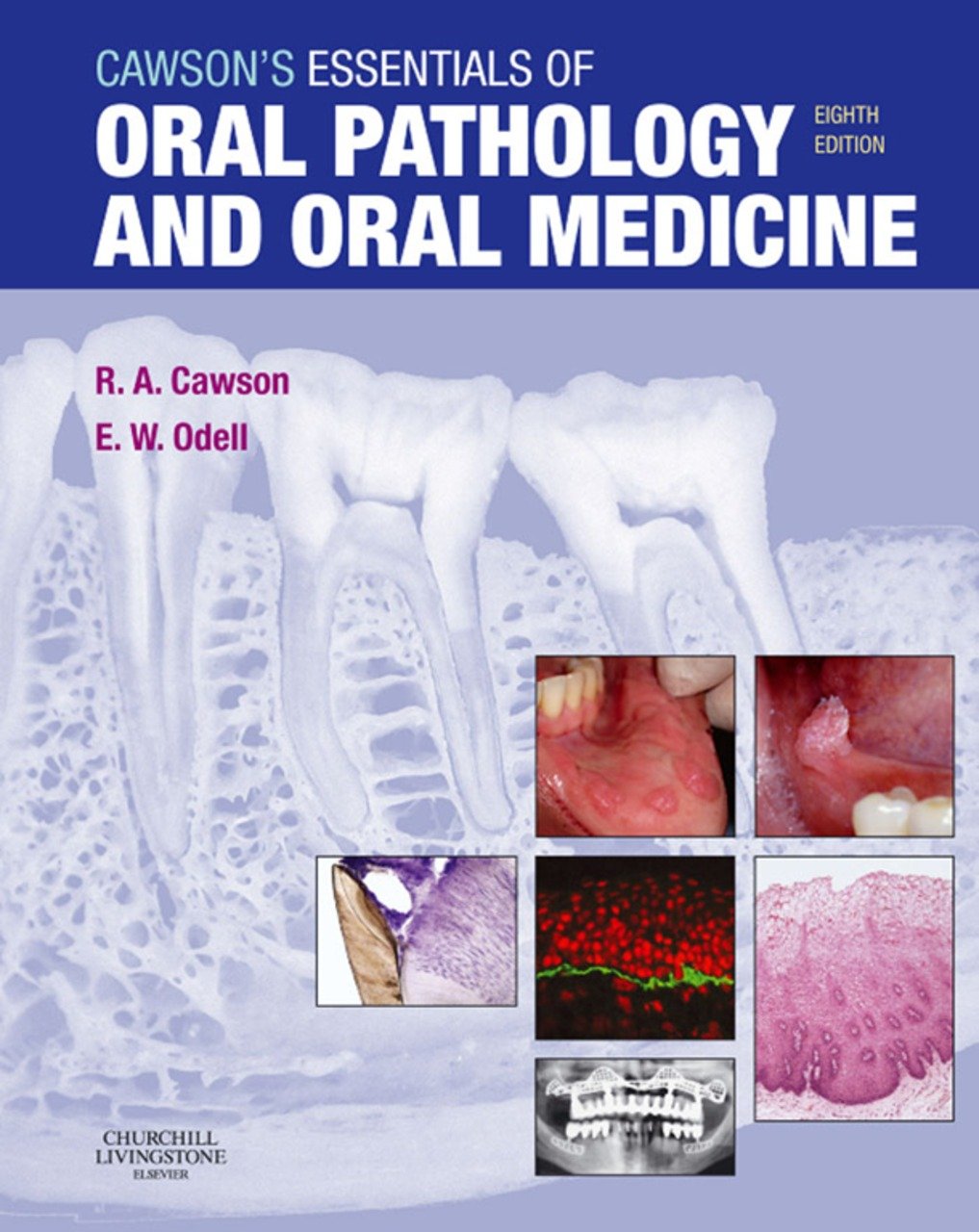 Cawson's Essentials of Oral Pathology and Oral Medicine E-Book (PDF/EPUB Version)