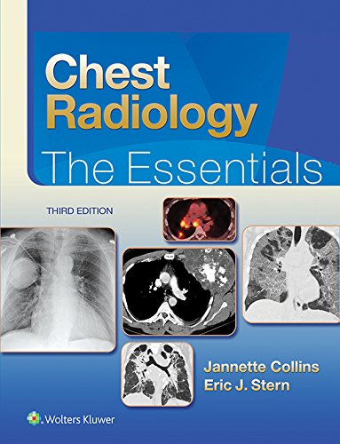 Chest Radiology: The Essentials (Essentials Series) (PDF/EPUB Version)