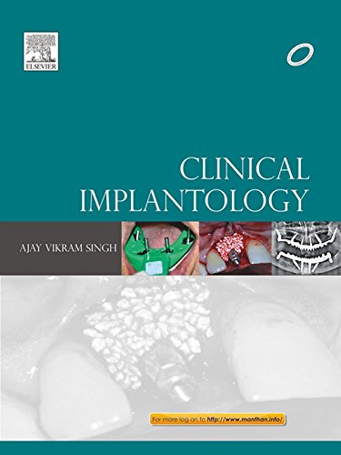 Clinical Implantology (PDF/EPUB Version)