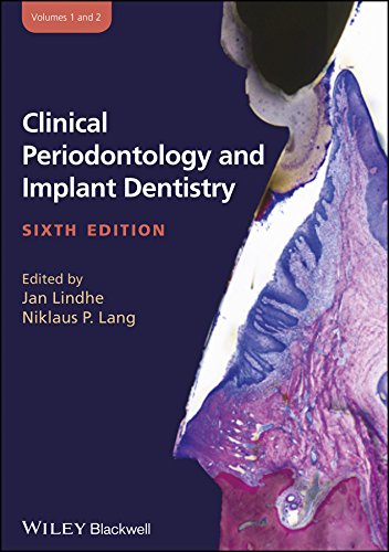 Clinical Periodontology and Implant Dentistry, 2 Volume Set (PDF/EPUB Version)