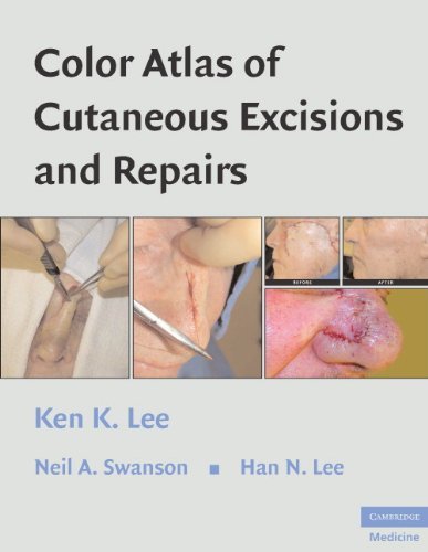 Color Atlas of Cutaneous Excisions and Repairs (PDF/EPUB Version)