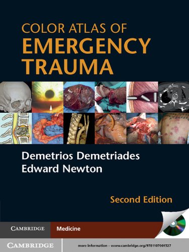 Color Atlas of Emergency Trauma (PDF/EPUB Version)