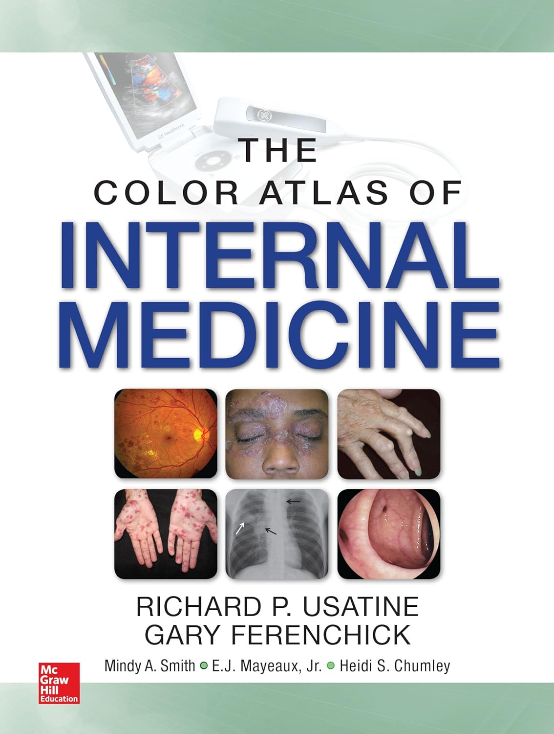 Color Atlas of Internal Medicine (PDF/EPUB Version)