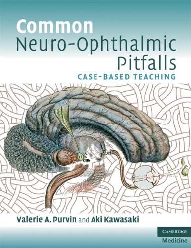 Common Neuro-Ophthalmic Pitfalls: Case-Based Teaching (Cambridge Medicine (Paperback)) (PDF/EPUB Version)