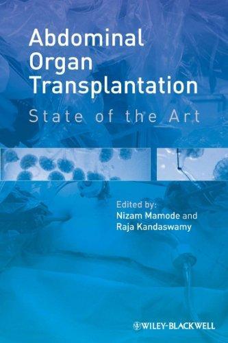 Abdominal Organ Transplantation State Of The Art