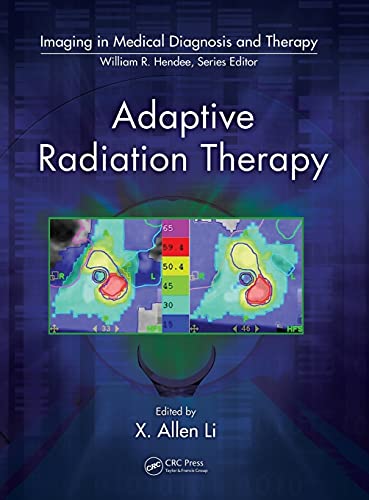 Adaptive radiation therapy