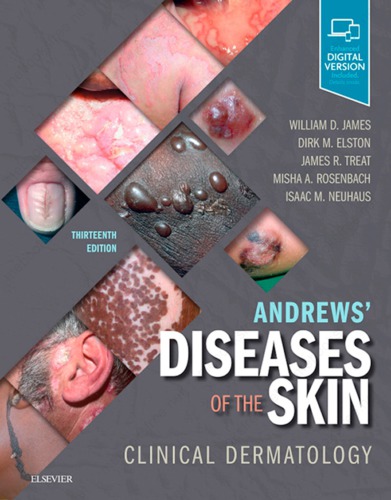 AndrewsÃ¢â‚¬â„¢ Diseases of the Skin: Clinical Dermatology