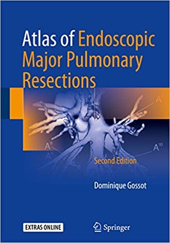 Atlas of Endoscopic Major Pulmonary Resections 2nd Edition