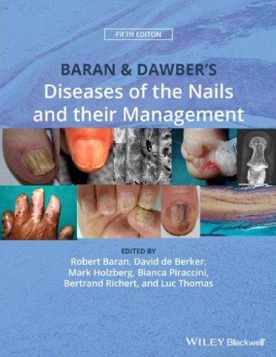 Baran &amp; DawberÃ¢â‚¬â„¢s Diseases of the Nails and their Management
