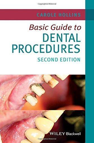 Basic Guide To Dental Procedures 2Nd Edition