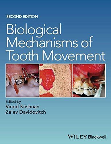 Biological Mechanisms Of Tooth Movement 2Nd Edition