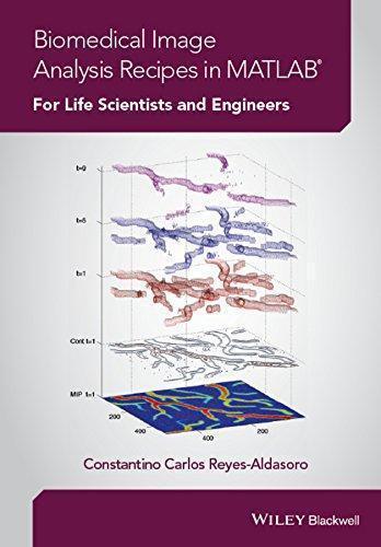 Biomedical Image Analysis Recipes In Matlab For Life Scientists And Engineers