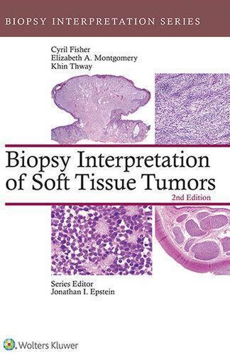Biopsy Interpretation Of Soft Tissue Tumors 2Nd Edition
