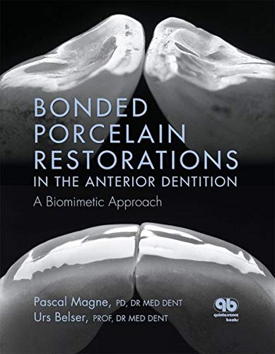 Bonded Porcelain Restorations in the Anterior Dentition A Biomimetic Approach