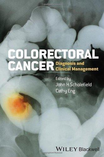 Colorectal Cancer Diagnosis And Clinical Management