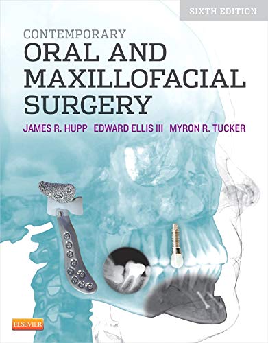 Contemporary Oral and Maxillofacial Surgery (6th Edition)