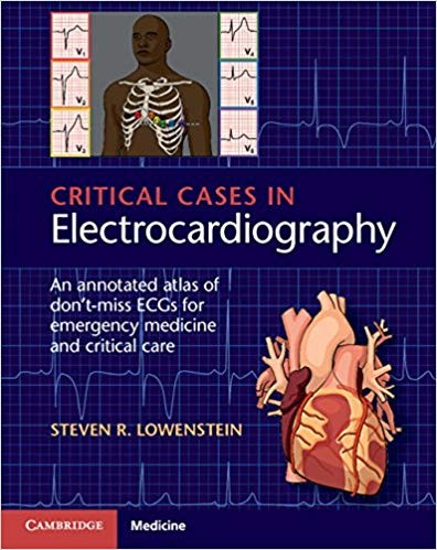 Critical Cases in Electrocardiography: An Annotated Atlas
