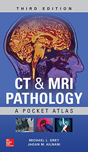 CT &amp; MRI Pathology: A Pocket Atlas, Third Edition