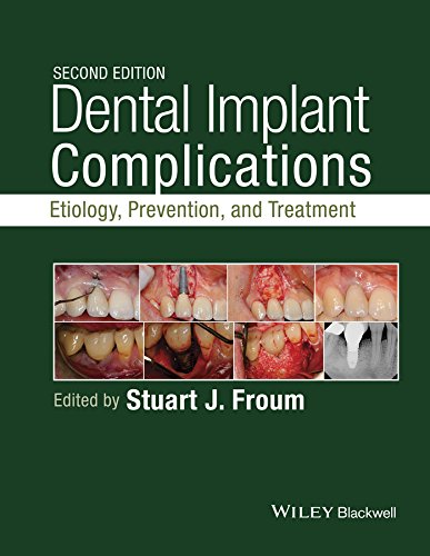Dental Implant Complications: Etiology, Prevention, and Treatment Ã¢â‚¬â€œ 2nd Edition