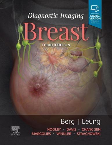 Diagnostic Imaging Breast 3Rd Edition