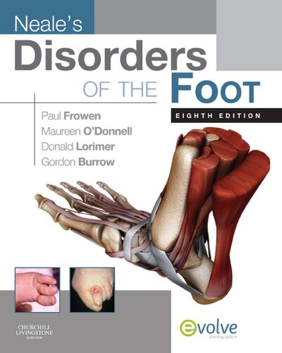 Disorders of the Foot