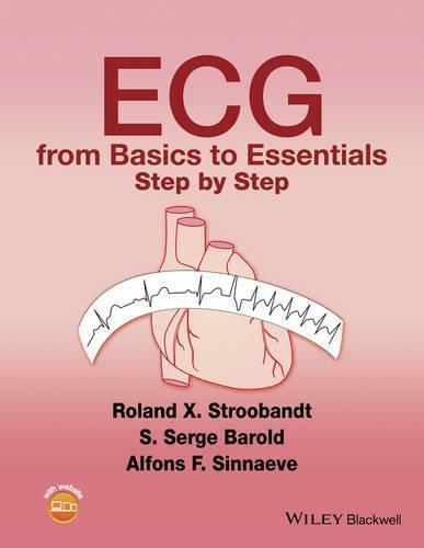 Ecg From Basics To Essentials Step